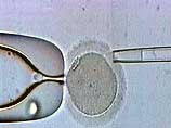 Американские ученые создали эмбрион, одновременно соединяющий в себе и мужские, и женские клетки