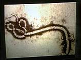 Вирус Эбола - один из самых опасных и быстро распространяющихся в мире. Смертность в результате заболевания лихорадкой Эбола составляет от 50% до 80%
