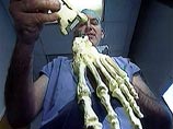 В США человеку успешно имплантирован протез руки, управляемый мыслями