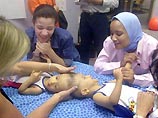 Американские врачи предпринимают попытку разделения сиамских близнецов, сросшихся черепами. Двухлетние Мохаммед и Ахмед Ибрагимы из Египта имеют одну на двоих важную артерию, но мозг у каждого свой