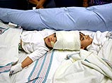 Первая из серии операций по разделению сросшихся головами полуторогодовалых сиамских близнецов из Филиппин проведена в понедельник в Нью-Йорке Первая из серии операций по разделению сросшихся головами полуторогодовалых сиамских близнецов из Филиппин проведена в понедельник в Нью-Йорке