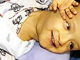 Разделенные в США сиамские близнецы из Египта отключены от аппаратов искусственного дыхания