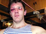 Один из нападавших держал Макарова, а второй бил его ногами в лицо
