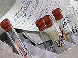 Быстрые тесты на определение ВИЧ-инфекции планируется ввести в широкую продажу в Москве, сообщил руководитель департамента здравоохранения столицы Андрей Сельцовский на пресс-конференции в пятницу