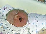 Еще семеро младенцев больны, у девятерых выделены возбудители Klebsiella pneumonia, сообщили в среду в пресс-службе областного Минздрава