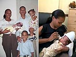 В Доминиканской республике врачи успешно удалили девочке вторую голову