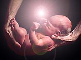 В Египте родился ребенок, излучающий электрические разряды В Египте родился ребенок, излучающий электрические разряды