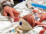 В США женщина за минуту родила шестерых младенцев