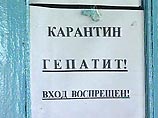 В Карачаево-Черкесии зарегистрирована вспышка гепатита: 180 человек госпитализированы 