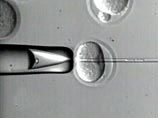 Ученым удалось вырастить кровеносные сосуды из стволовых клеток человеческого эмбриона