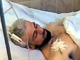 Сдавшийся чеченским правоохранительным органам начальник личной охраны Аслана Масхадова Шаа Турлаев после ампутации левой ноги в тяжелом состоянии находится в Гудермесской больнице