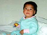 В Китае 50 младенцев умерли от "болезни большой головы"