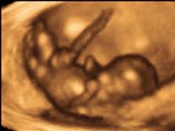 Новая техника ультразвукового исследования, созданная английским медиком, впервые позволила получить четкие фотографии 12-недельного человеческого плода в утробе матери