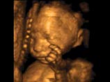 Британские медики получили уникальные фотографии ребенка, шагающего в утробе матери