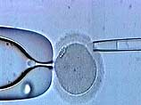 В Великобритании разрешено клонирование эмбриона человека для медицинских опытов