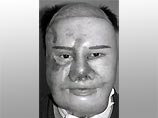 В Токио мужчине сделали новое лицо из единого куска кожи, взятой с его спины (ФОТО)