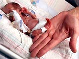 В больнице Чикаго готовят к выписке самого маленького ребенка в мире. Девочка Румаиса родилась значительно раньше положенного срока, и, к удивлению врачей, выжила. Ее вес составляет 227 грамм - это меньше, чем весит банка газировки