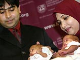 В США родился самый маленький ребенок на Земле: девочка весит 227 граммов В США родился самый маленький ребенок на Земле: девочка весит 227 граммов