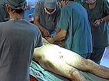 Грузинские хирурги провели уникальную операцию. Впервые в мире пациенту, который лишился полового члена в результате онкологического заболевания, пересадили вместо этого органа палец