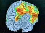 Либидо человека можно определить по его мозговым импульсам