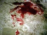 В результате нападения огнестрельные ранения получили четверо сотрудников службы безопасности завода В результате нападения огнестрельные ранения получили четверо сотрудников службы безопасности завода