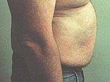 Исследователи установили, почему некоторые люди, которые сами себя считают лежебоками, остаются худыми, а другие толстеют