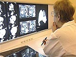 Японские ученые планируют использовать для ранней диагностики рака систему оптического распознавания рентгеновских снимков с искусственным интеллектом