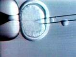Отец овечки Долли получил разрешение клонировать человеческий эмбрион
