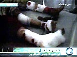 В результате авиаударов по пригороду Багдада ранены 9 человек