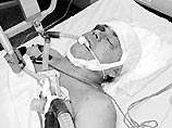 В НИИ им. Склифосовского ему была сделана последняя операция, после чего актера подключили к аппарату искусственной вентиляции легких. Караченцов до сих пор в состоянии комы