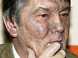 Госдеп признал, что Ющенко тайно лечили американские врачи