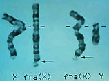 Ученые расшифровали Х-хромосому: женщины оказались сложнее, чем они думали