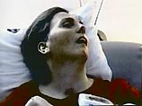 Женщина из-за необратимого поражения мозга уже 15 лет лежит в клинике штата Флорида без сознания в "вегетативном" состоянии, при котором ее жизнь искусственно поддерживается питательным раствором, подаваемым через трубку
