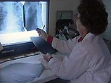 ВОЗ: официальные данные о заболеваемости туберкулезом в России сильно занижены ВОЗ: официальные данные о заболеваемости туберкулезом в России сильно занижены