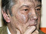 Отравленный диоксином президент Украины Виктор Ющенко живет в страхе перед развитием ракового заболевания