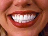 Белые зубы- это американская идея-фикс