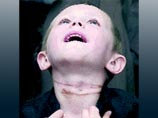 12-летняя девочка в суде ответит за избиение и повешение 5-летнего ребенка (ФОТО) 12-летняя девочка в суде ответит за избиение и повешение 5-летнего ребенка (ФОТО)