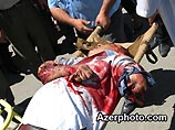 Глава Бакинского метро заявил, что в аварии эскалатора виноваты пассажиры Глава Бакинского метро заявил, что в аварии эскалатора виноваты пассажиры