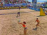 Увлечение пляжным волейболом может привести к обвисанию груди у женщин, предупреждают врачи