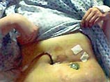 Британка чуть не умерла от регулярного употребления картофельных чипсов Британка чуть не умерла от регулярного употребления картофельных чипсов