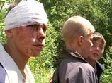 Автобус с детьми перевернулся в Иркутской области: 15 школьников ранены (ФОТО)
