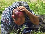 Нападения на врачей в Нижнем и Богдановиче: жертвами стали два хирурга и врач роддома Нападения на врачей в Нижнем и Богдановиче: жертвами стали два хирурга и врач роддома
