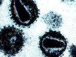New Scientist: Обрезание защищает мужчин от ВИЧ New Scientist: Обрезание защищает мужчин от ВИЧ