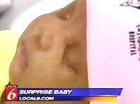 В Калифорнии женщина родила ребенка спустя несколько часов после того, как узнала о беременности (ФОТО)