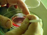 Израиль 40 лет скрывал препарат, способный помочь лечению СПИДа Израиль 40 лет скрывал препарат, способный помочь лечению СПИДа
