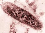 Бациллам туберкулеза 3 миллиона лет, утверждают ученые
