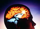 "Мозг - это пластичный организм, формируемый нашей деятельностью, - сказал профессор Иэн Робертсон. - Мы становимся более здоровыми, и продолжительность жизни увеличивается, но самая большая угроза при старении населения связана с функцией мозга"
