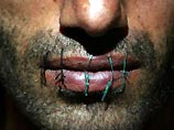 Заключенные тюрьмы в Батуми зашили себе рты в знак протеста