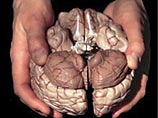 Cлужащий медицинской лаборатории в Австралии украл человеческий мозг