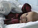 В больнице города Нетишина Хмельницкой области Украины, по данным на утро воскресенья, находятся 368 детей, отравившихся в детских садах, сообщили "Интерфаксу" в МЧС страны